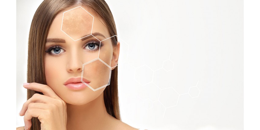 Mesotherapie: mit oder ohne Nadeln. Wir vergleichen die Wirksamkeit und den Komfort
