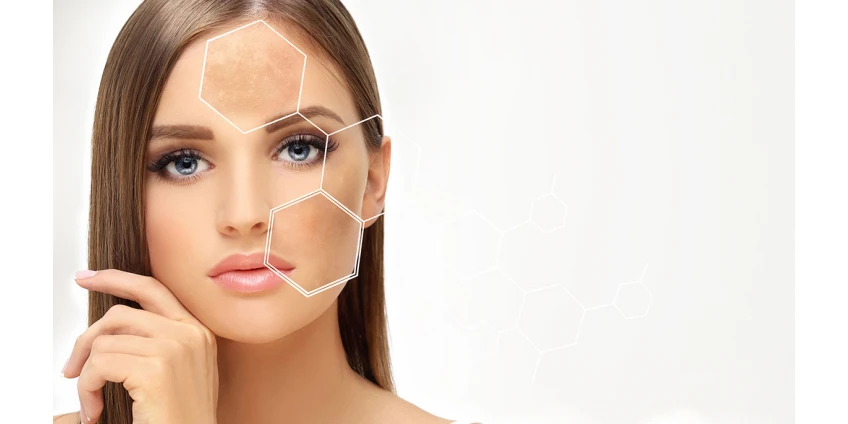 Mesotherapie: mit oder ohne Nadeln. Wir vergleichen die Wirksamkeit und den Komfort Mesotherapie: mit oder ohne Nadeln. Wir vergleichen die Wirksamkeit und den Komfort