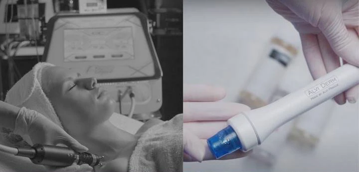 Sanfte apparative Behandlungen für empfindliche und allergische Haut