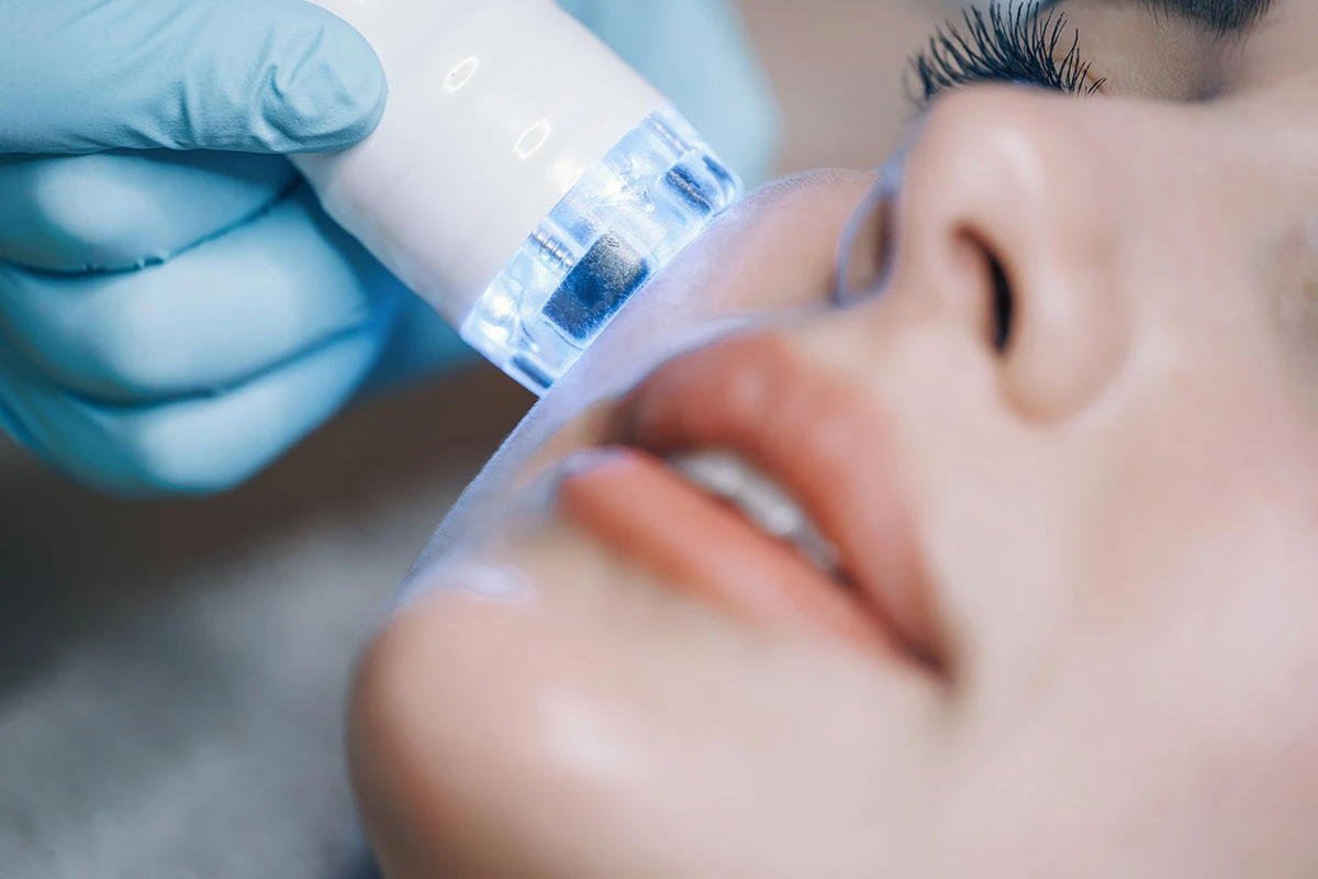 Was ist Hydrodermabrasion