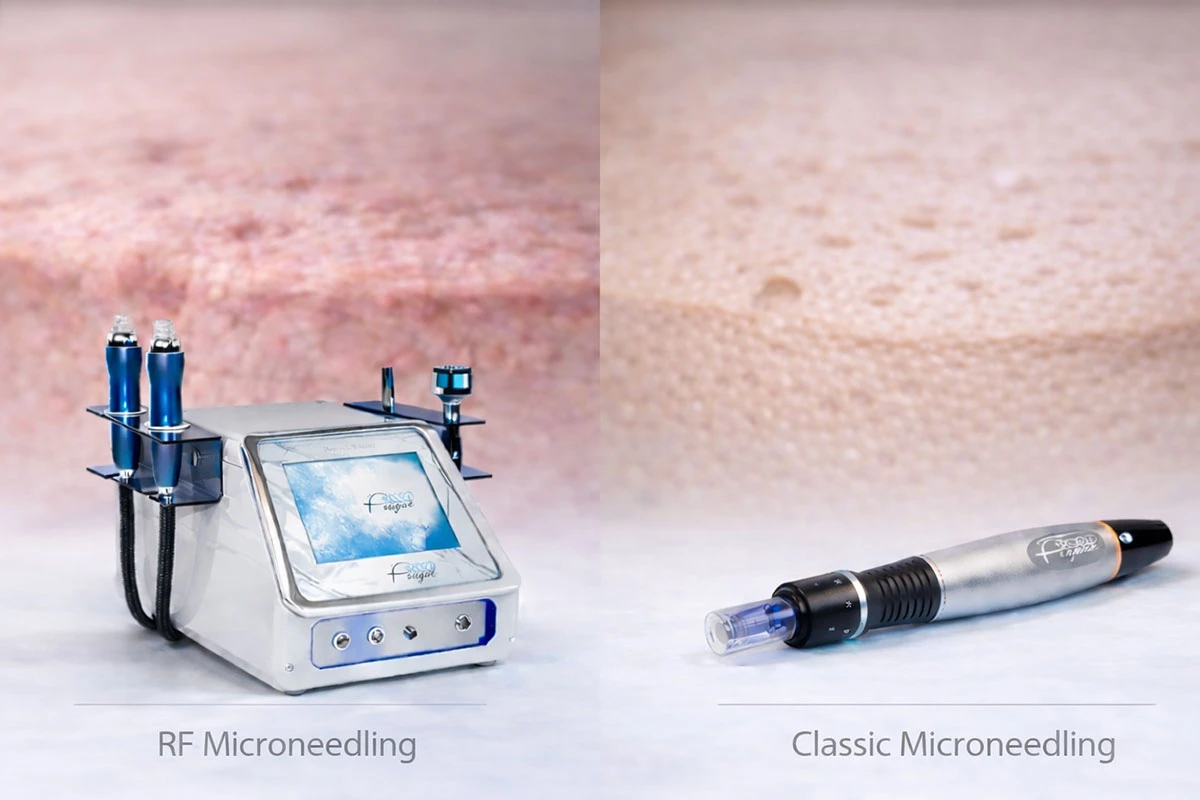 Radiofrequenz-Microneedling oder klassisches Microneedling