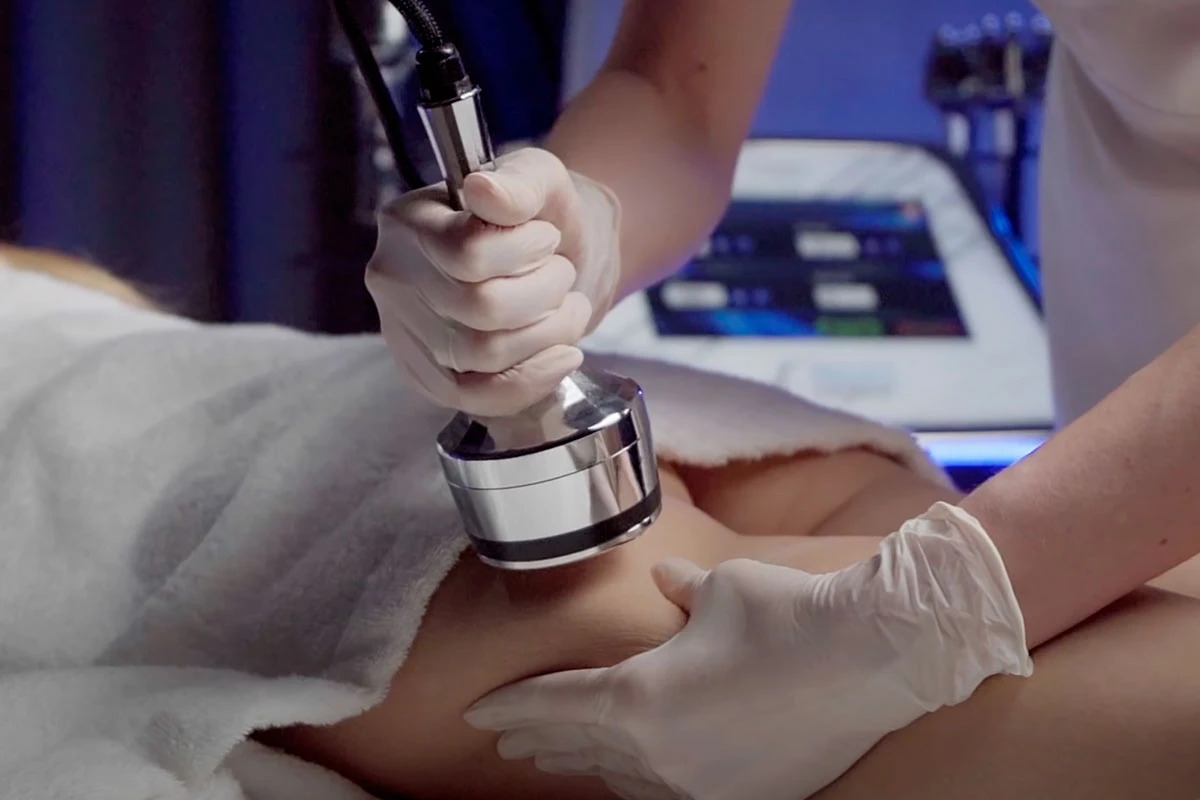 Ergebnisse und Haltbarkeit der Wirkung: was Kunden erwarten können