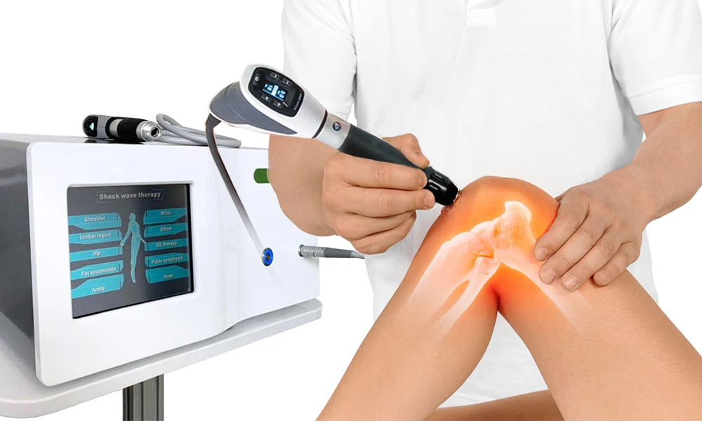 Stoßwellentherapie: Wirksamkeit und Vorteile